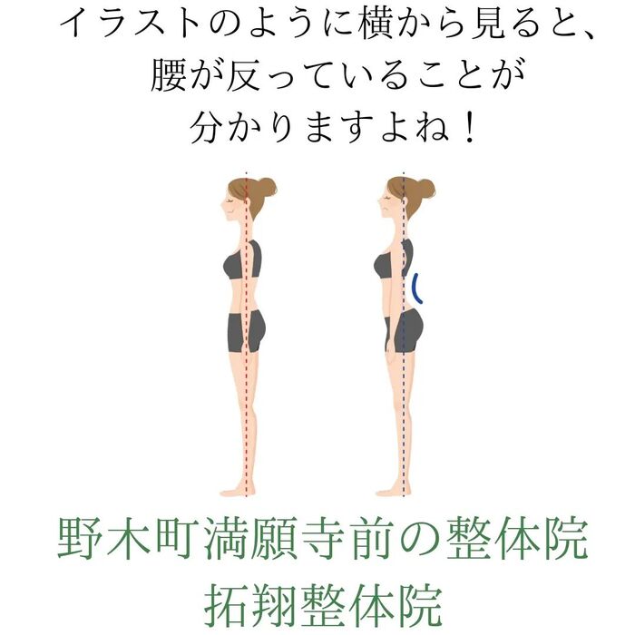画像381